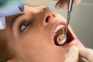 лечение зубного флюса